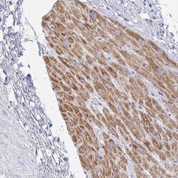Invitrogen SH3BGR Polyclonal Antibody 100 &mu;L; Unconjugated:Antibodies,