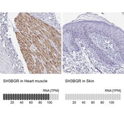 Invitrogen SH3BGR Polyclonal Antibody 100 &mu;L; Unconjugated:Antibodies,