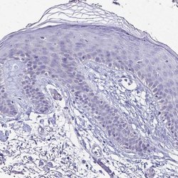 Invitrogen SH3BGR Polyclonal Antibody 100 &mu;L; Unconjugated:Antibodies,