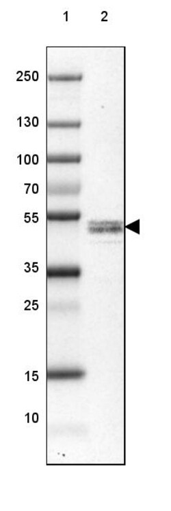 Invitrogen RCN2 Polyclonal Antibody 100 &mu;L; Unconjugated:Antibodies,