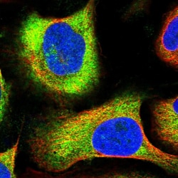 Invitrogen ARD1A Polyclonal Antibody 100 &mu;L; Unconjugated:Antibodies,