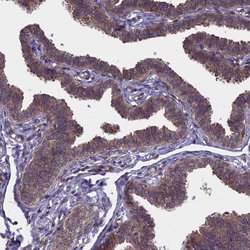 Invitrogen ARD1A Polyclonal Antibody 100 &mu;L; Unconjugated:Antibodies,