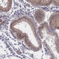 Invitrogen ARD1A Polyclonal Antibody 100 &mu;L; Unconjugated:Antibodies,