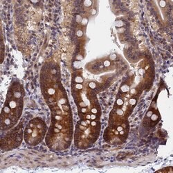 Invitrogen ARD1A Polyclonal Antibody 100 &mu;L; Unconjugated:Antibodies,