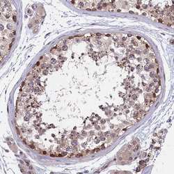 Invitrogen ARD1A Polyclonal Antibody 100 &mu;L; Unconjugated:Antibodies,