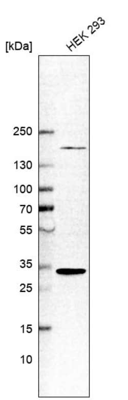 Invitrogen ARD1A Polyclonal Antibody 100 &mu;L; Unconjugated:Antibodies,
