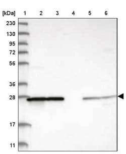 Invitrogen PMM1 Polyclonal Antibody 100 &mu;L; Unconjugated:Antibodies,