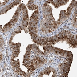 Invitrogen VMP1 Polyclonal Antibody 100 &mu;L; Unconjugated:Antibodies,