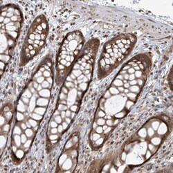 Invitrogen VMP1 Polyclonal Antibody 100 &mu;L; Unconjugated:Antibodies,