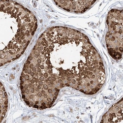 Invitrogen VMP1 Polyclonal Antibody 100 &mu;L; Unconjugated:Antibodies,