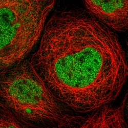 MKL1 Polyclonal Antibody:Antibodies, Polyclonal