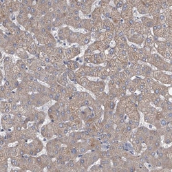 Invitrogen HEATR6 Polyclonal Antibody 100 &mu;L; Unconjugated:Antibodies,