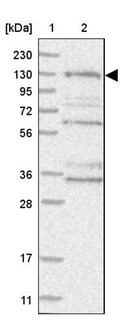 Invitrogen HEATR6 Polyclonal Antibody 100 &mu;L; Unconjugated:Antibodies,