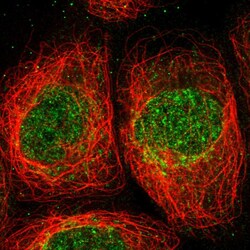 Invitrogen ANGEL2 Polyclonal Antibody 100 &mu;L; Unconjugated:Antibodies,