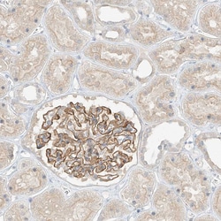 Invitrogen ANGEL2 Polyclonal Antibody 100 &mu;L; Unconjugated:Antibodies,