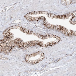 Invitrogen ANGEL2 Polyclonal Antibody 100 &mu;L; Unconjugated:Antibodies,