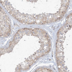 Invitrogen ANGEL2 Polyclonal Antibody 100 &mu;L; Unconjugated:Antibodies,