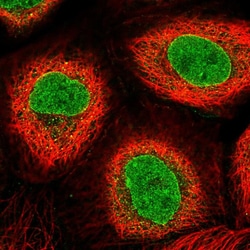 Invitrogen Adenylate Kinase 9 Polyclonal Antibody 100 &mu;L; Unconjugated:Antibodies,