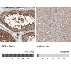 Invitrogen Adenylate Kinase 9 Polyclonal Antibody 100 &mu;L; Unconjugated:Antibodies,