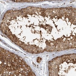 Invitrogen Adenylate Kinase 9 Polyclonal Antibody 100 &mu;L; Unconjugated:Antibodies,