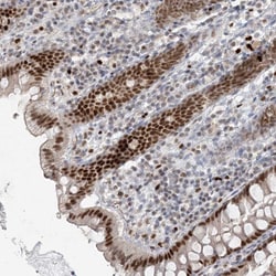 Invitrogen Adenylate Kinase 9 Polyclonal Antibody 100 &mu;L; Unconjugated:Antibodies,