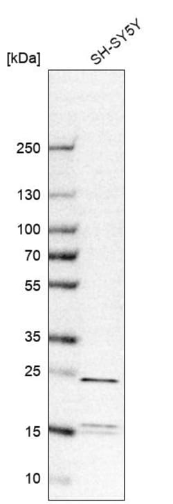 Invitrogen YKT6 Polyclonal Antibody 100 &mu;L; Unconjugated:Anticuerpos