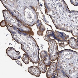 Invitrogen TASP1 Polyclonal Antibody 100 &mu;L; Unconjugated:Antibodies,