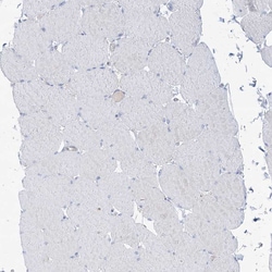 Invitrogen ATP11C Polyclonal Antibody 100 &mu;L; Unconjugated:Antibodies,