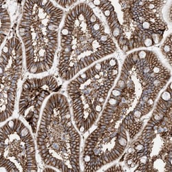 Invitrogen ATP11C Polyclonal Antibody 100 &mu;L; Unconjugated:Antibodies,