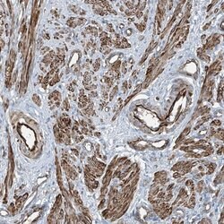 Invitrogen SH3BGRL3 Polyclonal Antibody 100 &mu;L; Unconjugated:Antibodies,