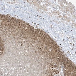 TBC1D2 Polyclonal Antibody:Antibodies, Polyclonal