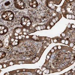 Invitrogen ZNF358 Polyclonal Antibody 100 &mu;L; Unconjugated:Antibodies,