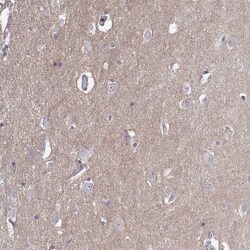Invitrogen NCAM2 Polyclonal Antibody 100 &mu;L; Unconjugated:Anticorps,