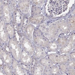 Invitrogen NCAM2 Polyclonal Antibody 100 &mu;L; Unconjugated:Anticorps,