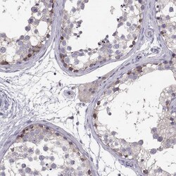 Invitrogen NCAM2 Polyclonal Antibody 100 &mu;L; Unconjugated:Anticorps,