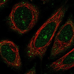 Invitrogen BRWD1 Polyclonal Antibody 100 &mu;L; Unconjugated:Antibodies,