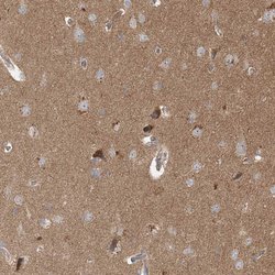 Invitrogen BRWD1 Polyclonal Antibody 100 &mu;L; Unconjugated:Antibodies,