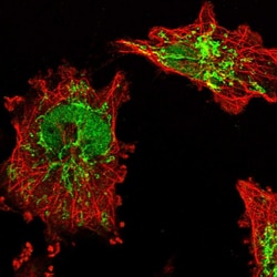 BDH1 Polyclonal Antibody:Antibodies, Polyclonal