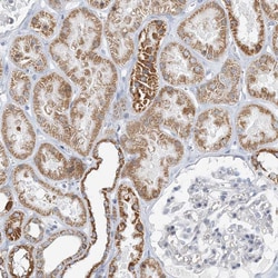 BDH1 Polyclonal Antibody:Antibodies, Polyclonal