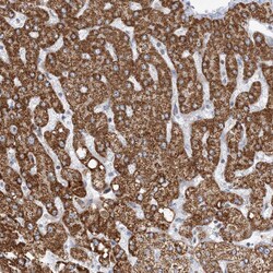 BDH1 Polyclonal Antibody:Antibodies, Polyclonal