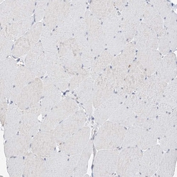 BDH1 Polyclonal Antibody:Antibodies, Polyclonal