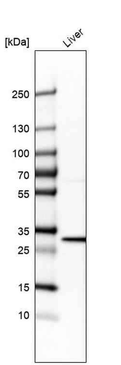 BDH1 Polyclonal Antibody:Antibodies, Polyclonal