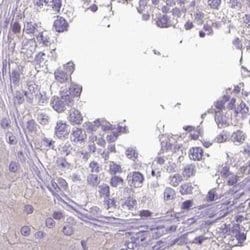Invitrogen LGSN Polyclonal Antibody 100 &mu;L; Unconjugated:Antibodies,