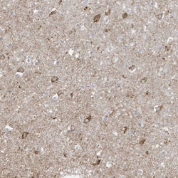 Invitrogen FNDC1 Polyclonal Antibody 100 &mu;L; Unconjugated:Antibodies,