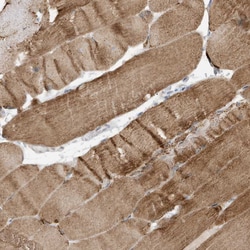 Invitrogen FNDC1 Polyclonal Antibody 100 &mu;L; Unconjugated:Antibodies,