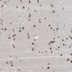 Invitrogen FNDC1 Polyclonal Antibody 100 &mu;L; Unconjugated:Antibodies,