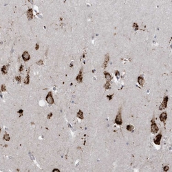 Invitrogen ZNF507 Polyclonal Antibody 100 &mu;L; Unconjugated:Antibodies,