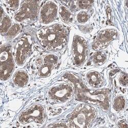 PPM1F Polyclonal Antibody:Antibodies, Polyclonal