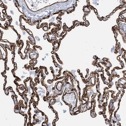 Invitrogen EPS8L3 Polyclonal Antibody 100 &mu;L; Unconjugated:Antibodies,