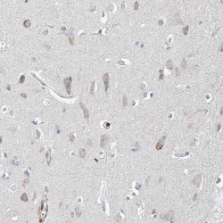 Invitrogen GALNTL6 Polyclonal Antibody 100 &mu;L; Unconjugated:Antibodies,